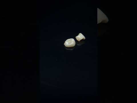 YouTube 썸네일