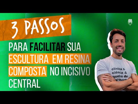 3 passos para facilitar sua escultura em resina composta no incisivo central