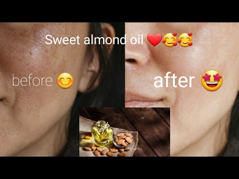 Almond Oil for Skin, Hair, and Face | 5 Benefits of...