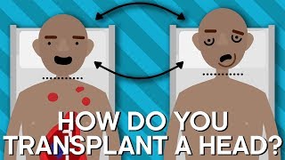 How Do You Transplant A Human Head? | Earth Lab
