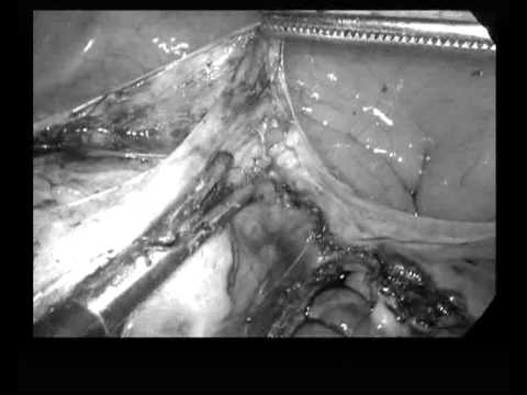 Rajani Hospital Video 8