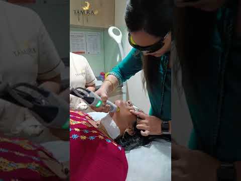 Laser Hair Reduction Treatment #laserhairremoval #laseronface #facialhair #laserhairremoval