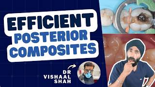 Posterior Composites Done Right - PDP266