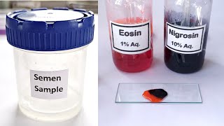 Semen Analysis Test Lab | Sperm Viability Test
