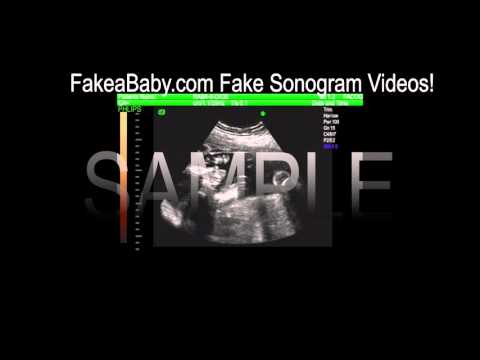 Fake Sonogram Maker Free
