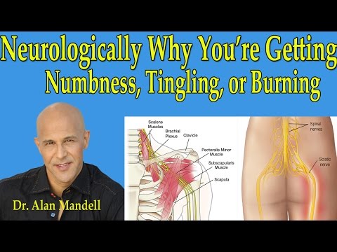 Neurologically Why You're Getting Numbness,Tingling, or Burning in Arms or Legs - Dr Mandell