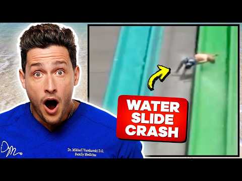 Doctor Reacts To Theme Park Injuries