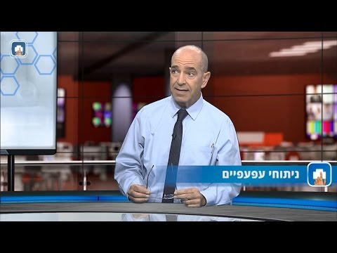 ניתוחי עפעפיים: המילון הרפואי