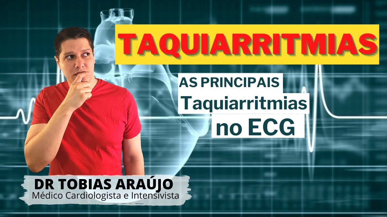 As principais taquiarritmias no ECG / Interpretação do ECG