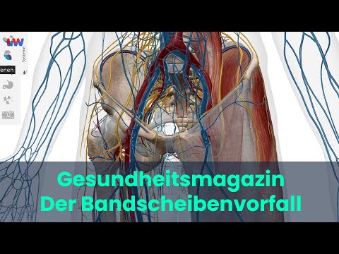 Kamenz: Gesundheitsmagazin - Der Bandscheibenvorfall - mit Tobias Jantsch - LAUSITZWELLE