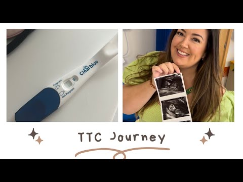 UNEXPLAINED INFERTILITY JOURNEY- miracle baby 🥺
