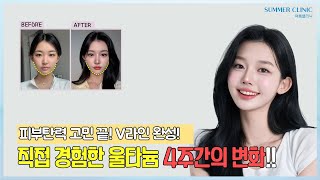 피부탄력 고민 끝! 직접 경험한 울타늄 4주간의 이야기!