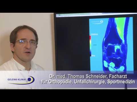 Osteoarthritis des Knies 2 Grad und Ausbildung Wie Rückenschmerzen Vitamine behandeln