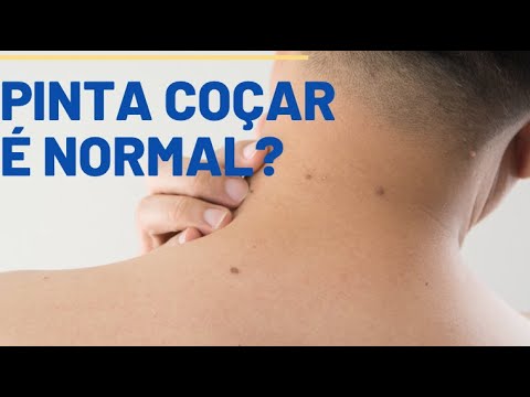 Pinta que coça é normal? Existe perigo? Por Luiz Gameiro, dermatologista