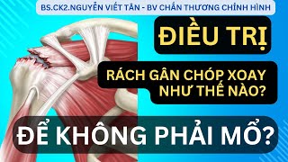 ĐIỀU TRỊ RÁCH GÂN CHÓP XOAY NHƯ THẾ NÀO ĐỂ KHÔNG PHẢI MỔ? - Khớp Việt Official