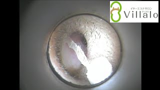 耳掃除動画vol.24「薄い耳垢」