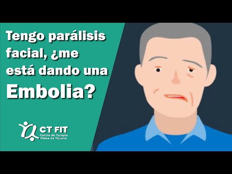 Tengo parálisis facial ¿Me está dando una embolia? | Centro de Terapia Física de Tijuana