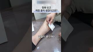 장화와 피부의 마찰 자극, 상처와 색소침착 관리