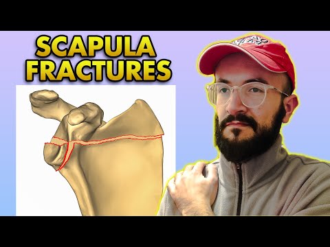 Scapula Bone Fractures: Anatomy, Classification, Clinical Features and Treatment