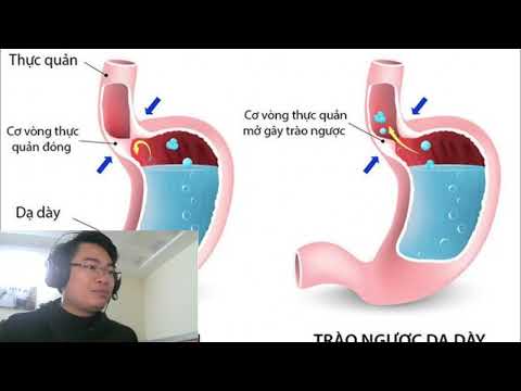 3 Things People with Acid Reflux Must Know About Throat Choking and Bloating - Part 1