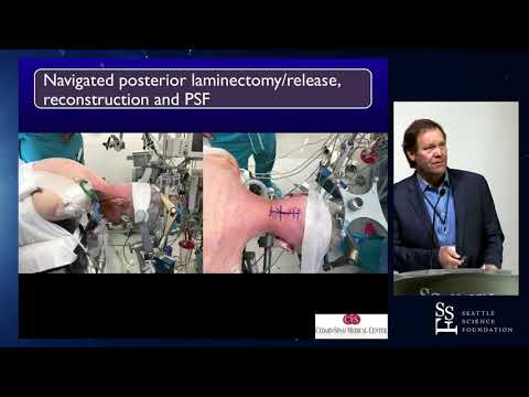 Benefits and Expanded Indications for Spinal Navigation - J. Patrick Johnson, MD