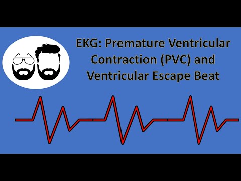 EKG Series: Premature Ventricular Contraction (PVC) and Ventricular Escape Beats