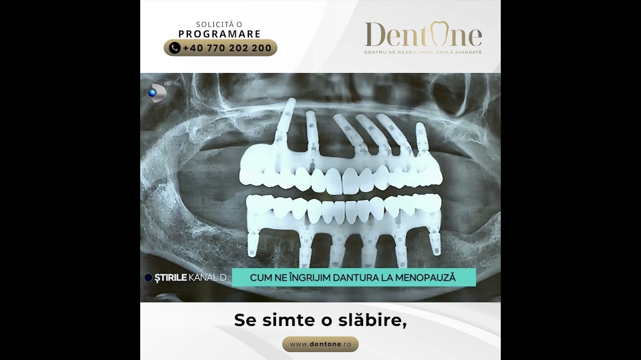 Menopauza și sănătatea dentară – ce trebuie să știi