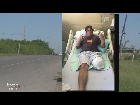 Motorcyclist who lost leg sends safety message to fellow ROT Rally bikers