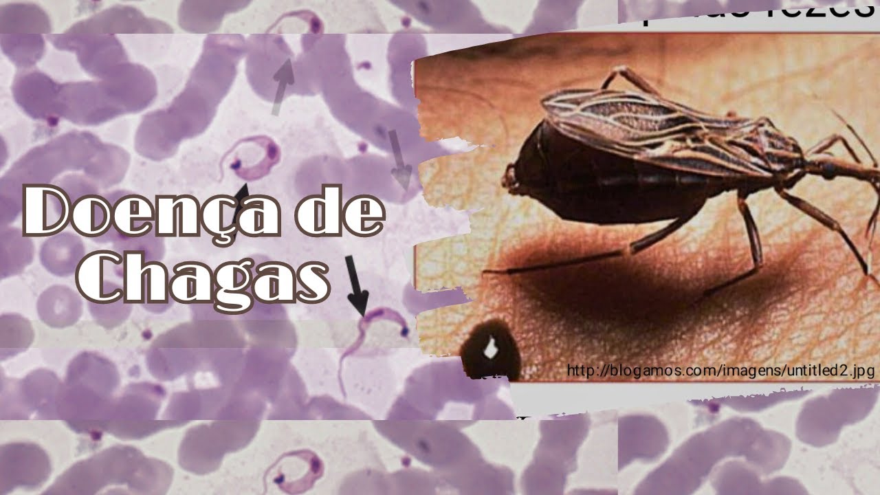Doença de chagas - Ciclo de vida do protozoário T.cruzi