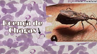 Doença de chagas - Ciclo de vida do protozoário T.cruzi