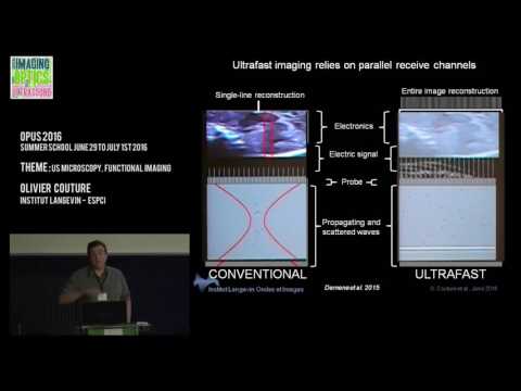Olivier Couture - Us microscopy, functional imaging - Opus 2016