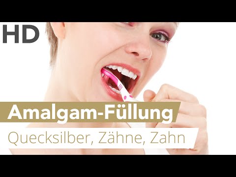 Amalgamfüllungen: Wirklich so schädlich?
