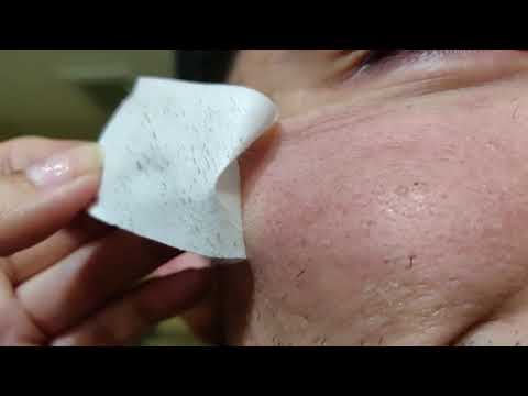 BlackheadsCure - Lanbena Blackheads Remover Strips