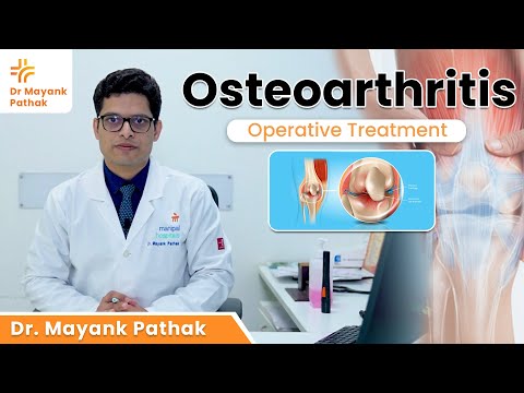 Osteoarthritis Surgeries | Dr. Mayank Pathak