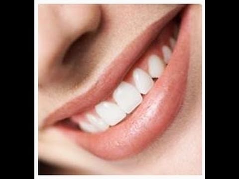 Los blancos casa tener en como dientes