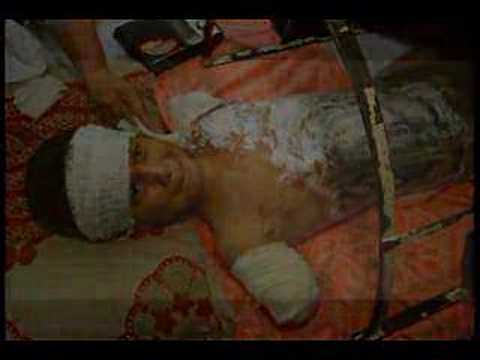 Star System Blacktica