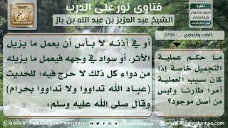 2799 - حكم عملية التجميل  -  نور على الدرب image