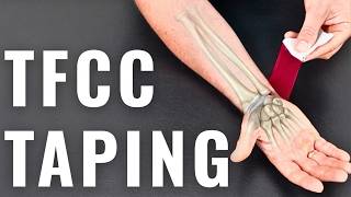 TFCC & ECU Wrist Pain Taping (RockTape Kinesiology Tape Technique)