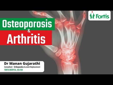 Osteoporosis &amp; Arthritis | Dr. Manan Gujarathi