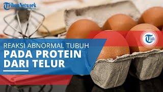 Alergi Telur, Suatu Reaksi Abnormal dari Sistem Kekebalan Tubuh terhadap Protein Telur