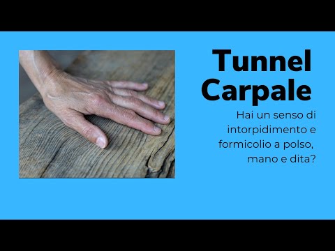 Carpal tunnel? Here's what you can do to ease the pain.