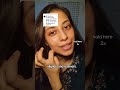 I Hope This Helps Types Of Retainers Aligners Retainers Dentist Skyjournalswithsana