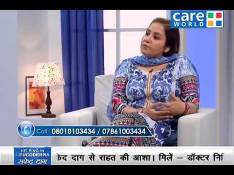 Link Between Safed Daag & Dried Fruits