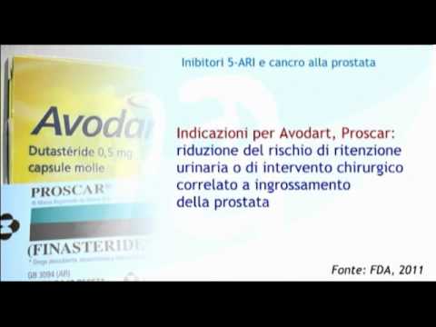 Cosa sono le calcificazioni Cosa sono le calcificazioni