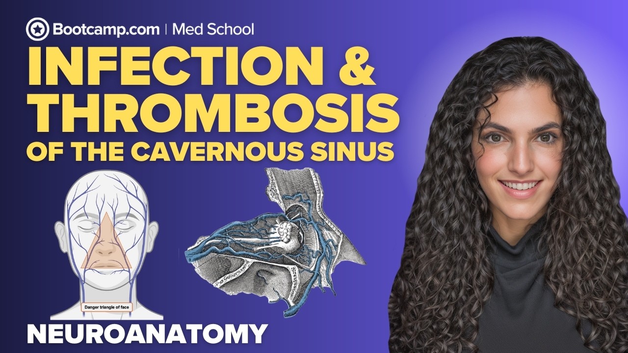 Infection & Thrombosis of the Cavernous Sinus | Symptoms, Causes & Clinical Signs