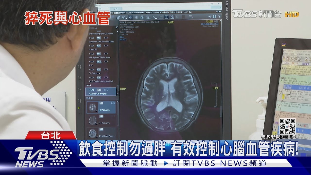 全台每年約5千至1萬人「猝死」 出現這症狀...急速就醫!