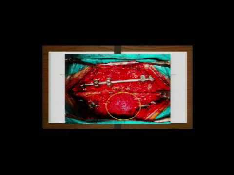 CCR Neuro Surgery Geriatric Medicine- 09.08.2016