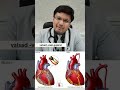 Bypass Surgery How Long Do Grafts Last