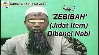 Download lagu ZEBIBAH: THE DARK FOREHEAD MARK HATED BY THE PROPHET | DARK MARKS ON THE FOREHEAD ARE NOT ISLAMIC... mp3 Download lagu ZEBIBAH: THE DARK FOREHEAD MARK HATED BY THE PROPHET | DARK MARKS ON THE FOREHEAD ARE NOT ISLAMIC... mp3