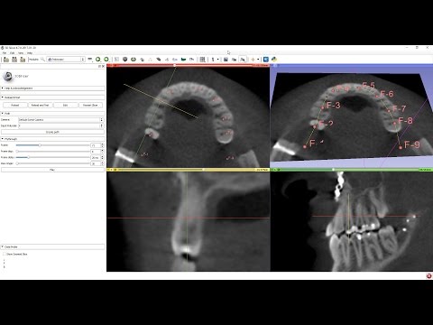 Curved multi-planar reconstruction (MPR) view in 3D Slicer